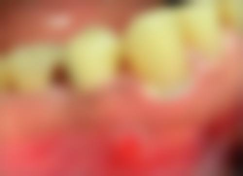 成都茁悦口腔门诊部冯李娟医生口碑评价