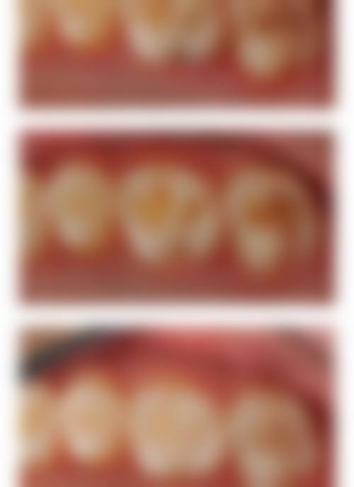 北京妇产医院刘恒医生简介