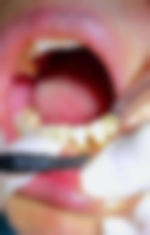 吉林省中医和西医结合医院刘恒医生技术特色