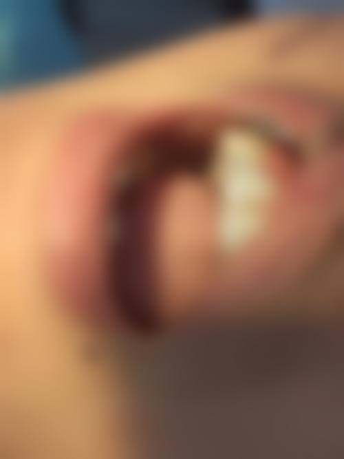 北京大学第一医院刘恒医生擅长项目