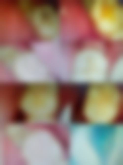 北京大学第一医院刘恒医生技术特色