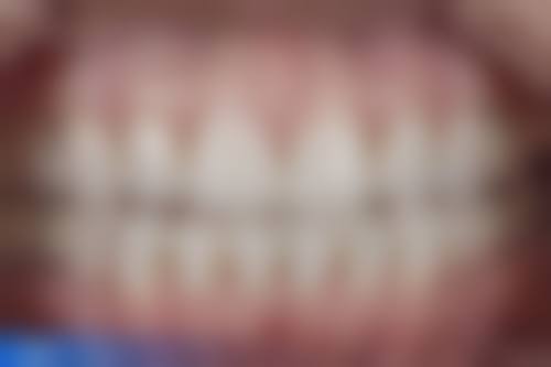 成都斯托玛亚非口腔门诊部张瑞泽医生技术特色