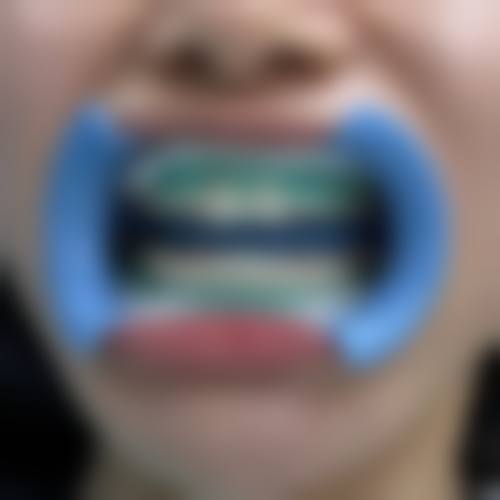 北京维尔口腔医院许君医生怎么预约挂号