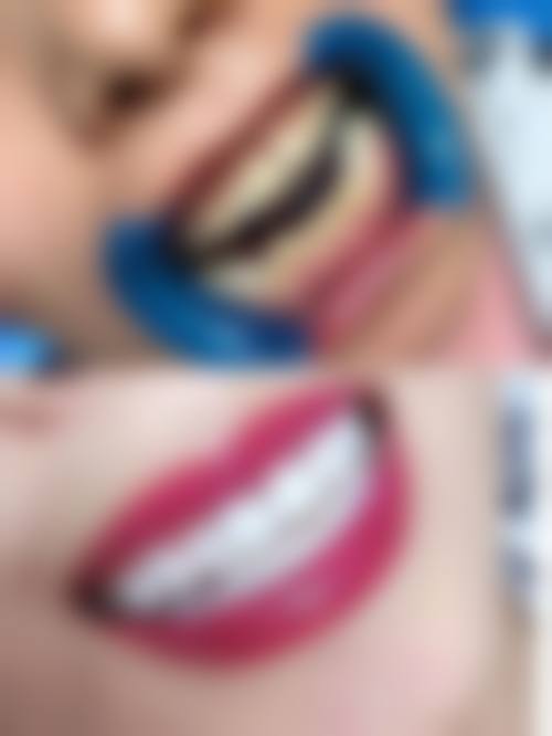 北京中科领军刘家窑口腔医院许君医生口碑评价