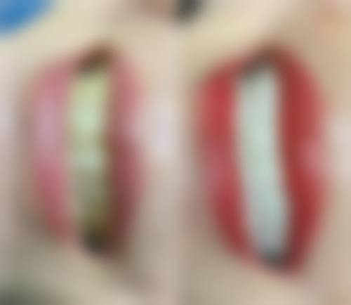 桓台县人民医院许君医生技术特色