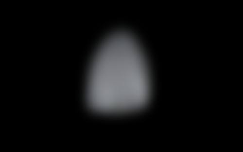 杭州市儿童医院许君医生擅长项目