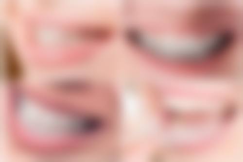 江西宜春丰城爱牙口腔诊所医院预约方式