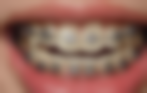 上海维乐口腔门诊（唐镇店）医院预约方式