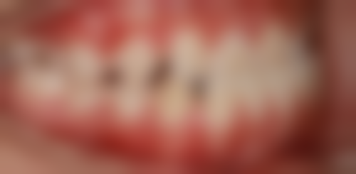 成都蜀星贝佳口腔门诊部医院特色项目