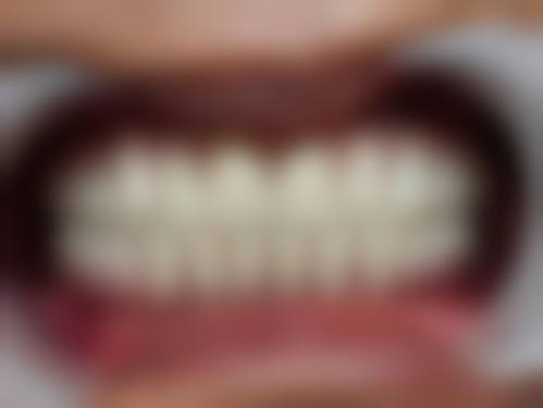 成都茁悦口腔门诊部罗鸿思医生擅长项目