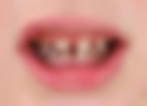 成都茁悦口腔门诊部罗鸿思医生技术特色