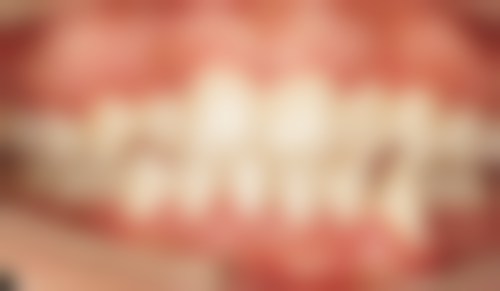 湘潭康诚口腔医院预约方式