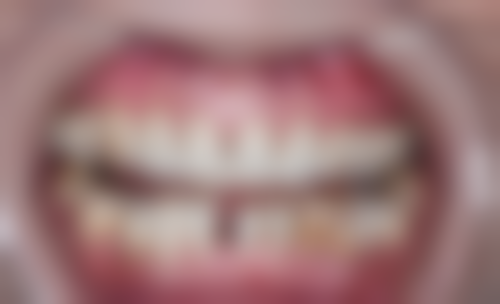 沈阳二0四 医院朱钰医生怎么预约挂号