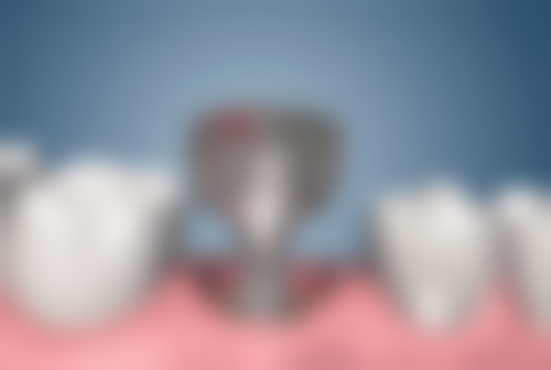 沈阳二0四 医院朱钰医生技术特色