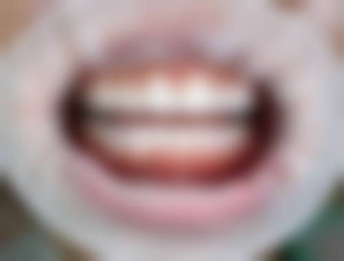 沈阳二0四 医院朱钰医生怎么预约