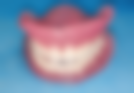 广东中山益立口腔医院项目价格