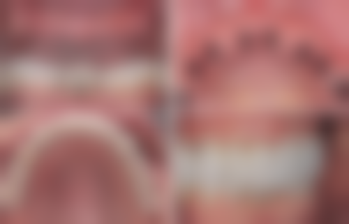 沈阳二0四 医院朱钰医生技术特色