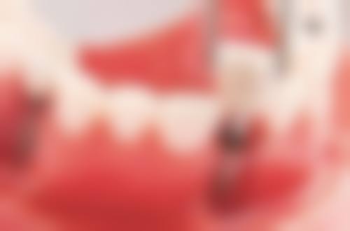 上海交通大学医学校附属第九人民医院朱钰医生技术特色