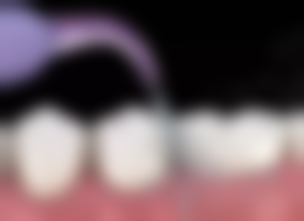 长春民康雅贝嘉口腔民康路店医院项目价格