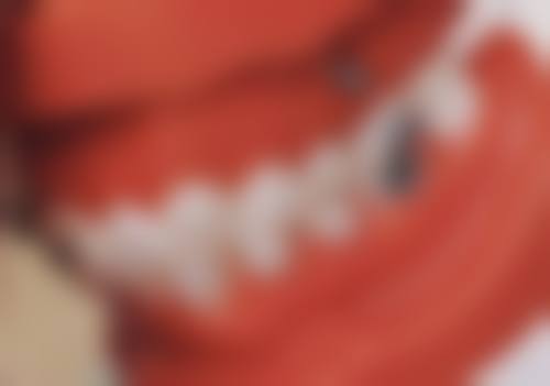 深圳王桂娣口腔诊所医院项目价格