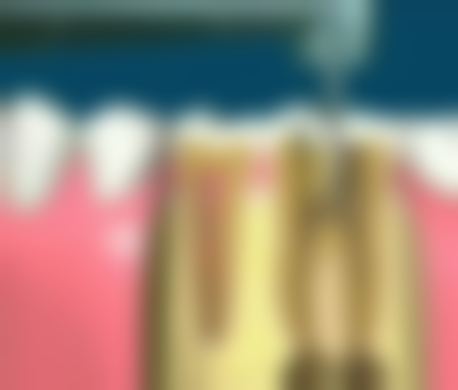 丰县星璨医疗美容门诊部(口腔科)医院项目价格