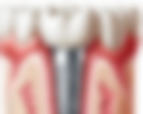 江苏苏州太仓夏君军口腔医院顾客的口碑评价