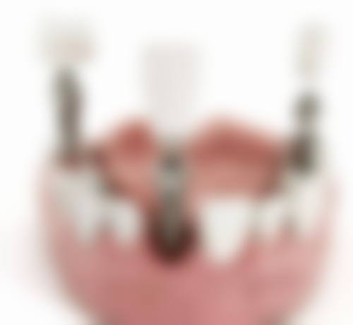 河南省立眼科医院祝磊医生技术特色