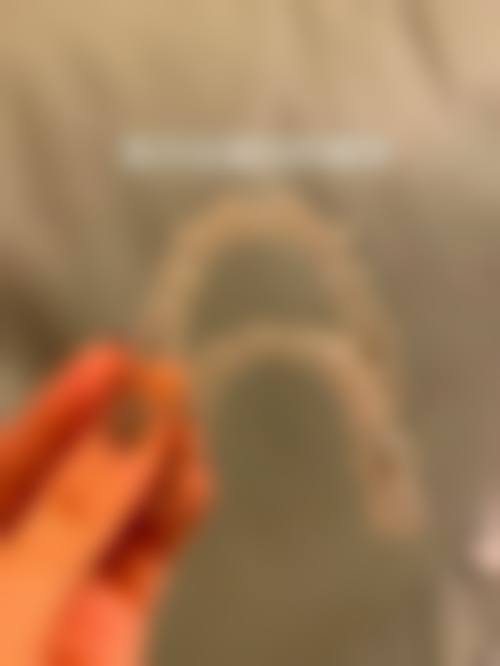 襄阳市中 心医院张婧医生简介