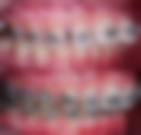 贵阳市第二人民医院张婧医生口碑评价