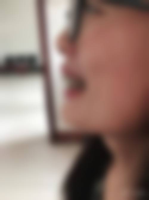 襄阳市中 心医院张婧医生口碑评价