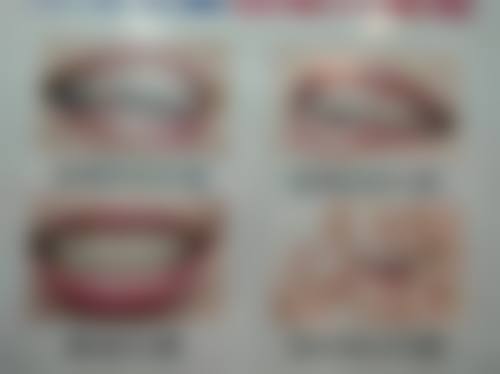 北京延庆格兰口腔总店（植美口腔）张婧医生的收费价格表