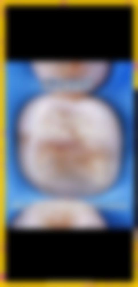 福州登特口腔医院林键医生擅长项目