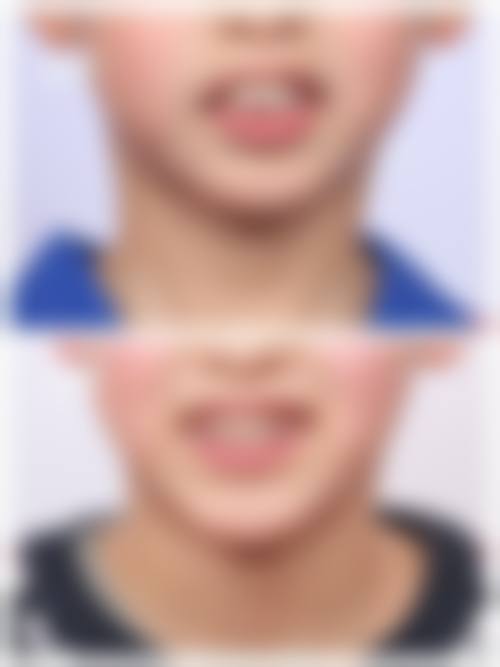 烟台市蓬莱区妇幼保健院张婧医生擅长项目