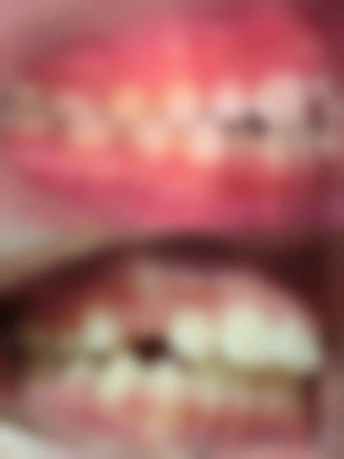 襄阳市中 心医院张婧医生技术特色