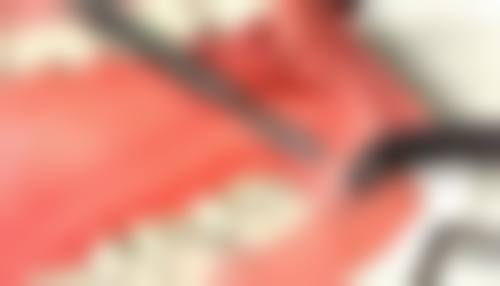 四川大学华 西医院胡倩医生口碑评价