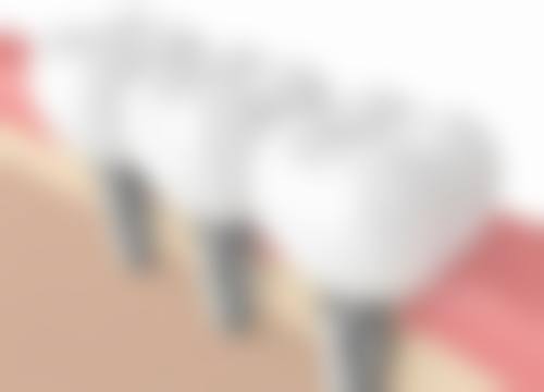 新余市人民医院刘军华医生技术特色