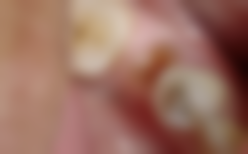 大连市甘井子区妇幼保健院张草医生口碑评价