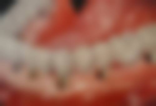 西安市精神卫生中 心张凯医生擅长项目