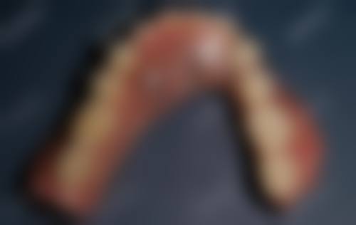 中日医院张凯医生技术特色