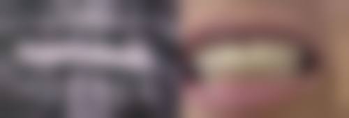 西安市精神卫生中 心张凯医生简介