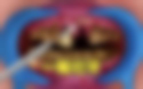 四川大学华 西医院胡倩医生的收费价格表