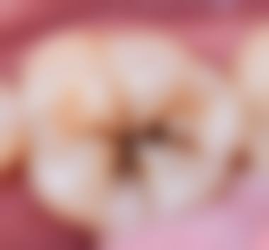 北京医院胡倩医生技术特色