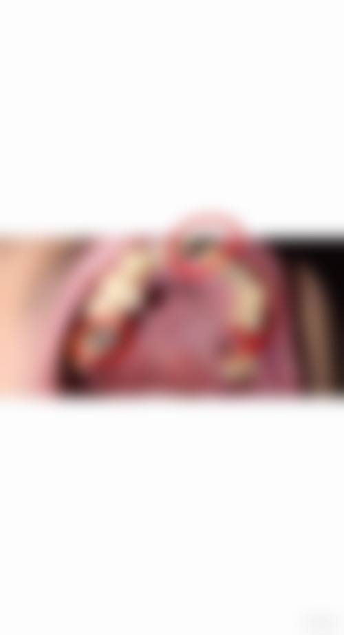 四川大学华 西医院胡倩医生擅长项目