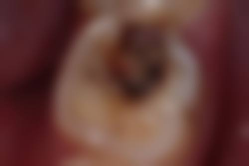 梁山县馆驿卫生院胡倩医生技术特色