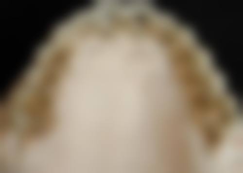 浙江省人民医院于泳医生擅长项目