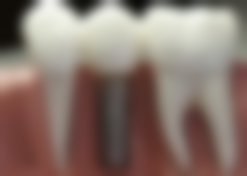 咸阳215医院口腔科(陕西省核工业二一五医院口腔科)医院来院路线