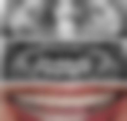 深圳美莱口腔于泳医生技术特色