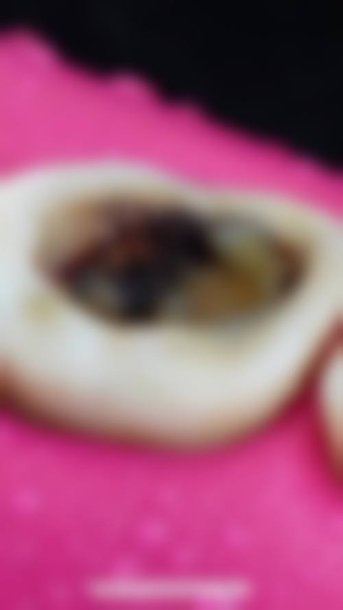 宁夏医 科 大学总医院冯进医生技术特色