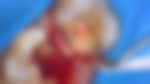 咸阳215医院口腔科(陕西省核工业二一五医院口腔科)医院特色项目