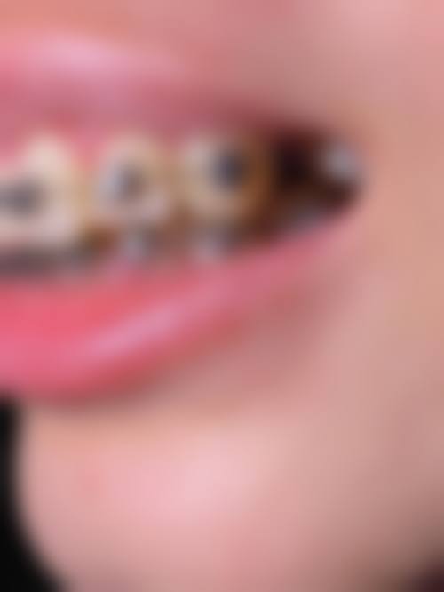 福建医 科 大学附属协和医院陈文华医生简介